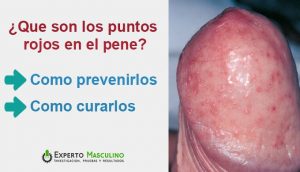 puntos rojos en la cabeza del pene